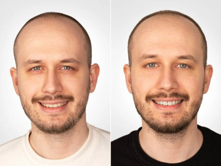 Anti-Aging Eye Patches