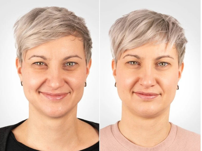 Anti-Aging Eye Patches